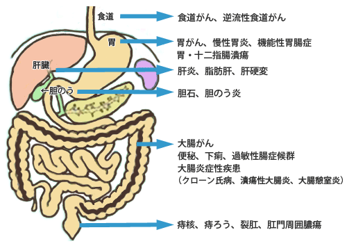 主な消化器疾患